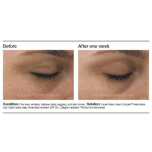 Load image into Gallery viewer, PCA SKIN Ideal Complex Restorative Eye Cream
