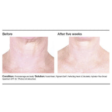 Load image into Gallery viewer, PCA SKIN Perfecting Neck &amp; Décolleté
